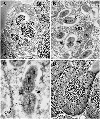 The Symbiosome: Legume and Rhizobia Co-evolution toward a Nitrogen-Fixing Organelle?